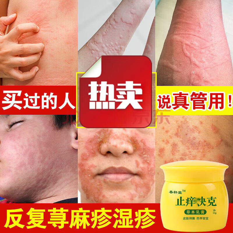 百年春轩堂急慢性过敏痒克快抑菌膏皮肤过敏皮肤瘙痒急慢性荨l麻l疹皮l炎 买3+2【五盒巩固装】