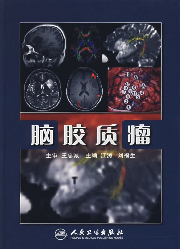 脑胶质瘤 江涛 等主编 人民卫生出版社