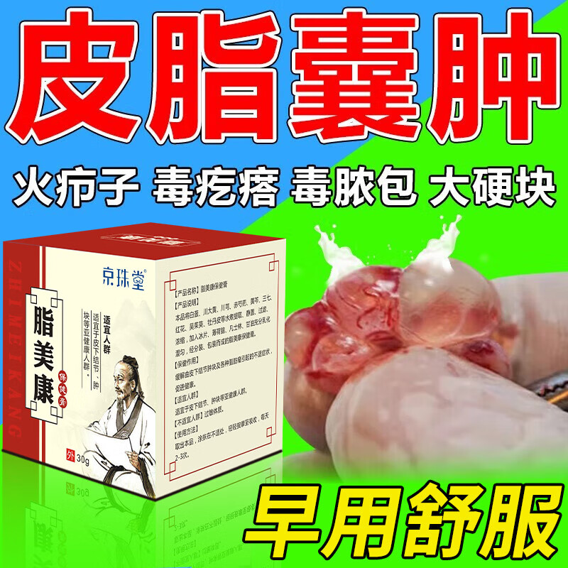 京东官方旗舰店自营粉瘤消除膏治皮脂腺囊肿药膏专用去除皮下皮脂腺排