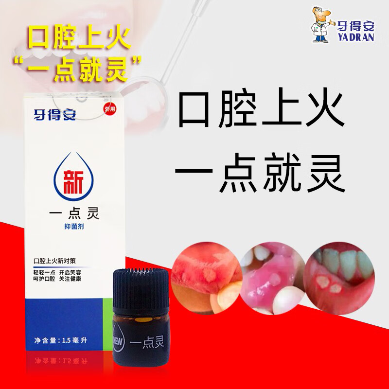 牙得安口腔溃疡一点灵送棉棒牙镜清洁口腔抑菌液黏膜下火不适上火含漱液 1.5mlx1瓶装+涂药棒100根+牙镜