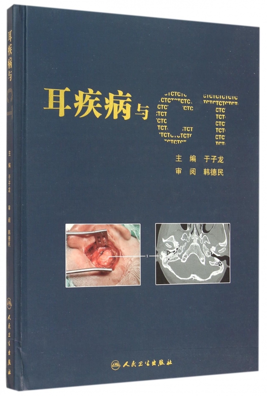 耳疾病与CT(精)