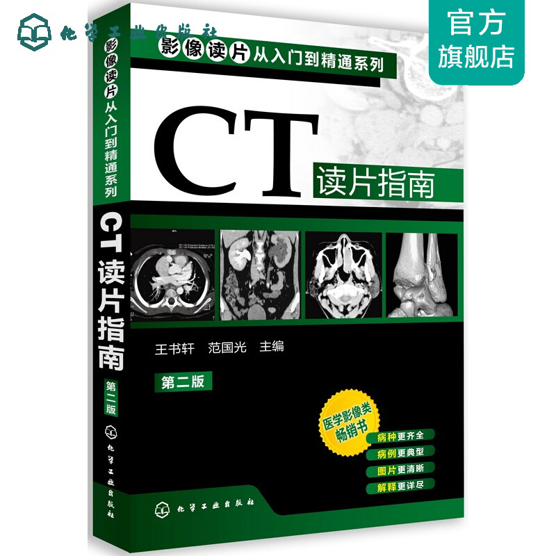 影像读片从入门到精通系列--CT读片指南(二版)
