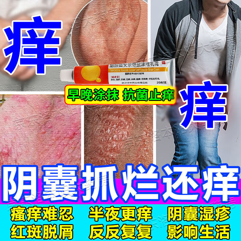 治阴囊湿疹药膏下体瘙痒男 阴囊瘙痒湿疹止痒私处睾丸丸潮湿痒皮肤