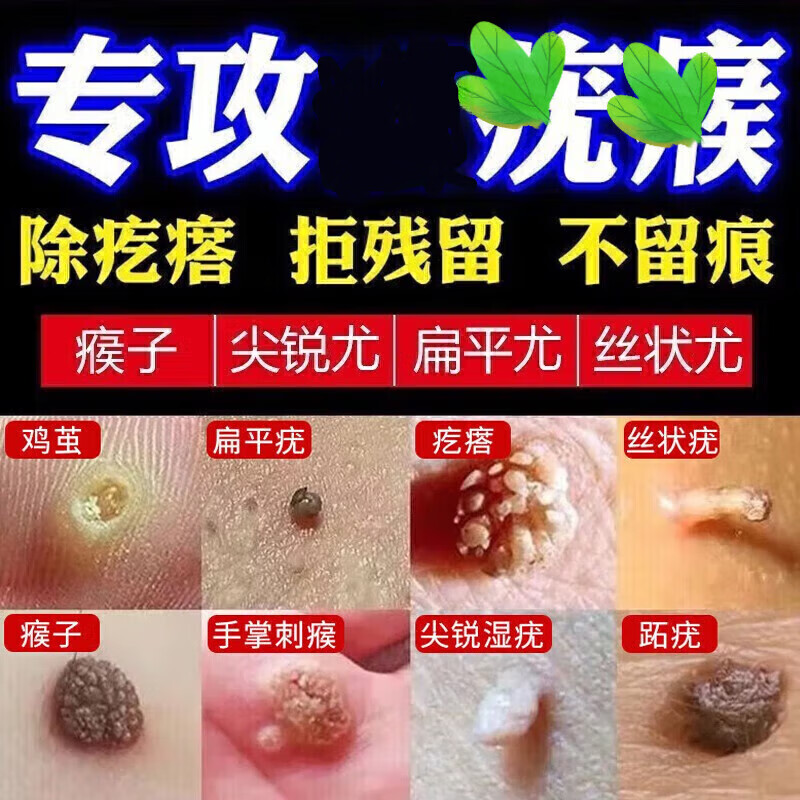 韩贝恋内廷上用疣清宁搭咪喹奎莫特乳膏5软膏疣克去除疣灵肉粒刺猴