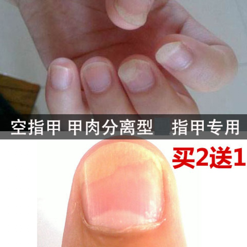 指甲营养油美甲护理 空甲分离修甲剥离症手指甲空甲肉脚趾甲变空壳心