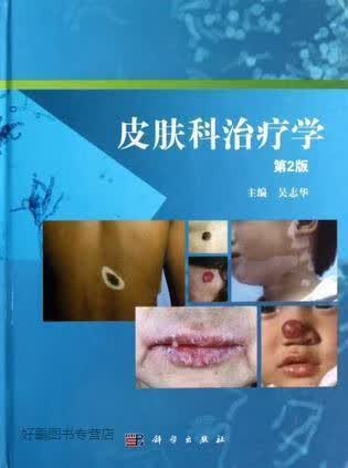 皮肤科治疗学 第2版,吴志华编,科学出版社,9787030356840
