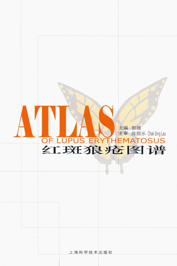 红斑狼疮图谱【稀缺图书,放心购买】