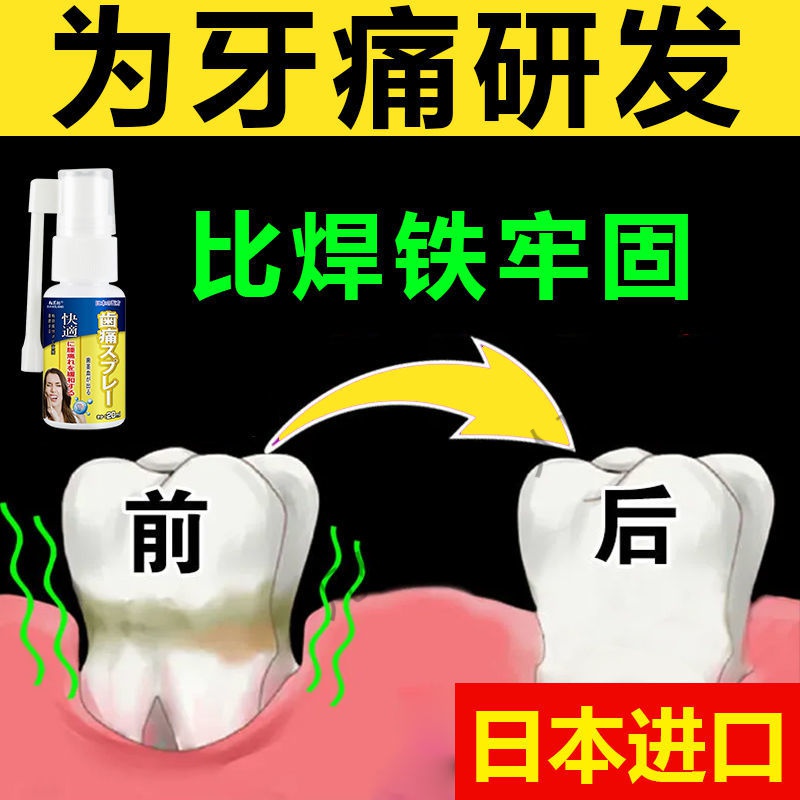 日本进口牙痛牙疼特效l箹蛀牙虫牙洞上火牙龈肿痛神经快速消l炎喷剂 【买3+2】发5瓶【疗程装】