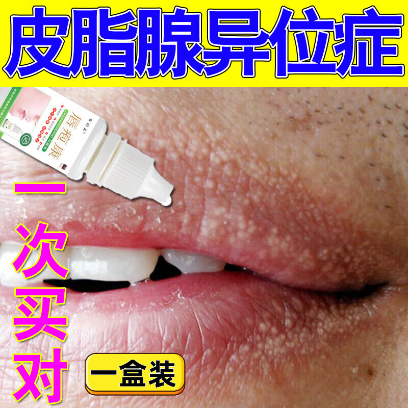 大医生嘴巴上火起泡口唇干燥烂唇疱l专用去死皮嘴唇干裂嘴角燎泡 1