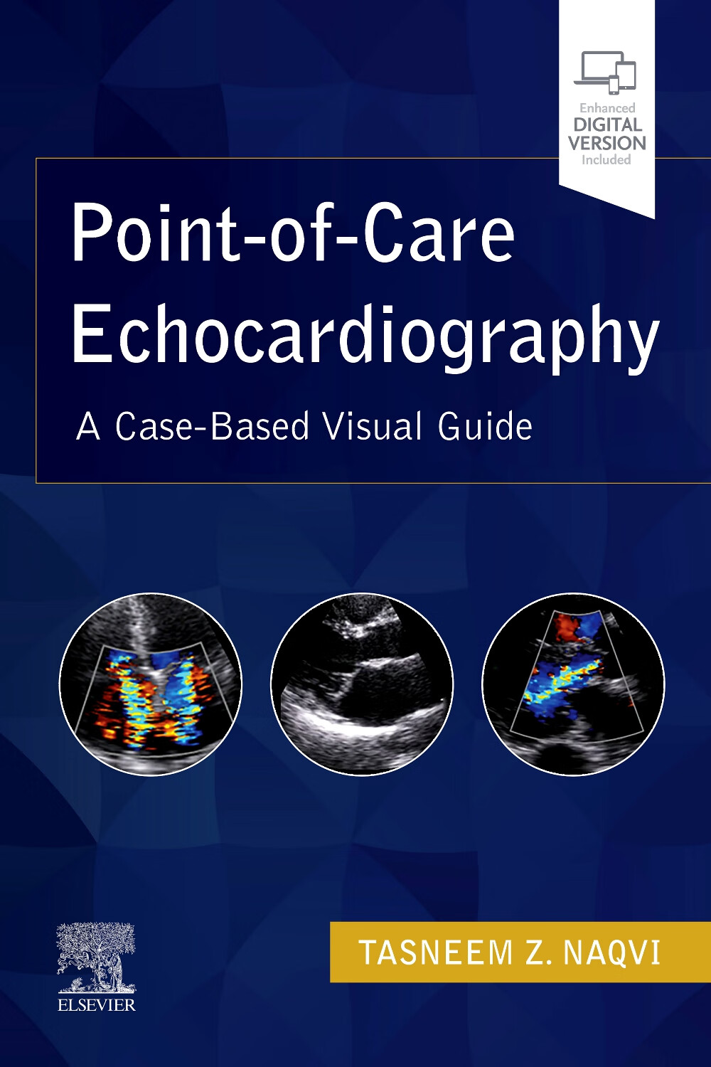 point-of-care echocardiography 点超声心动图 放射和影像学 英文
