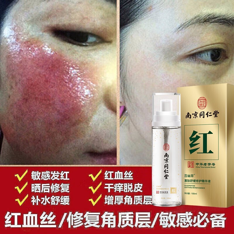 百幽草红血丝舒缓精华液修复敏感肌加厚角质层薄泛红肌肤高原红补水保湿 修护红血丝修复角质层