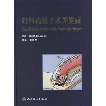 妇科内镜手术并发症