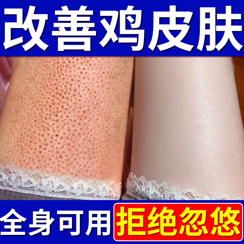 beiyvs去鸡皮肤毛囊炎磨砂膏手臂鸡皮肤疙瘩去除角质身体护理 1支
