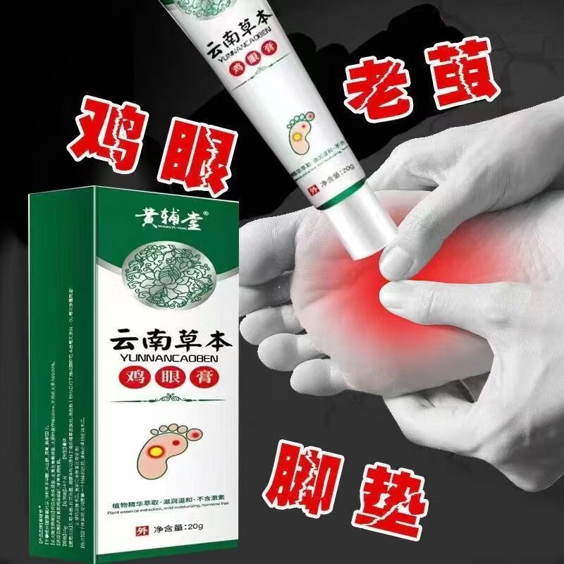 膏鸡眼膏脚底祛脚垫脚茧厚茧鸡眼祛肉刺 2899倍效[严重鸡眼]超强效果2