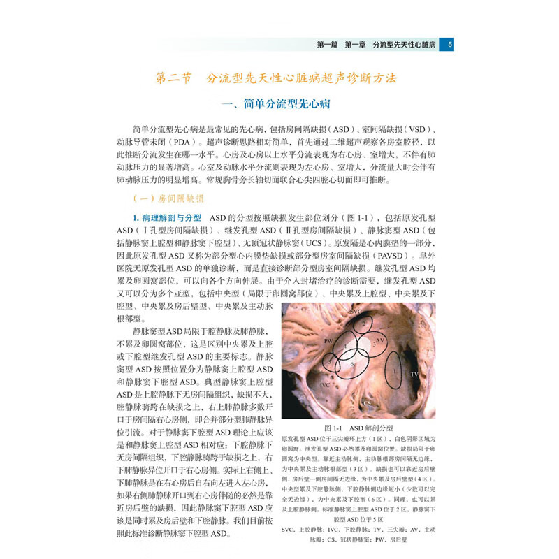 逄坤静超声心动图学手册临床诊断指南阜外医院超声心动图临床诊断病理