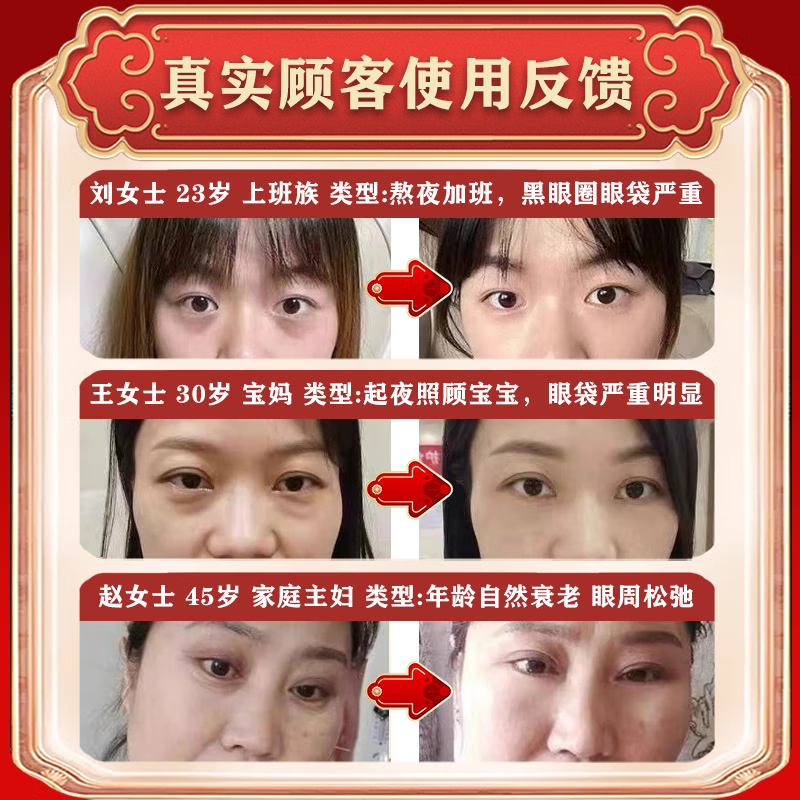 欧诱（Eurpattract）眼袋霜去大眼袋严重中老年专用消除重度男女士眼袋祛去除神器贴膜 一盒试用装 提拉紧致抗皱淡化黑眼圈最好的眼霜