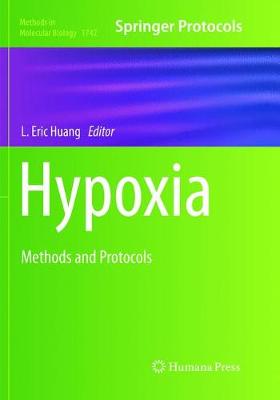 【预订】hypoxia: methods and protocols