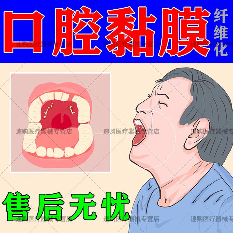 官方口腔黏膜纤维化修复液槟榔口腔黏膜纤维化修复喷剂味觉减退舌 1盒