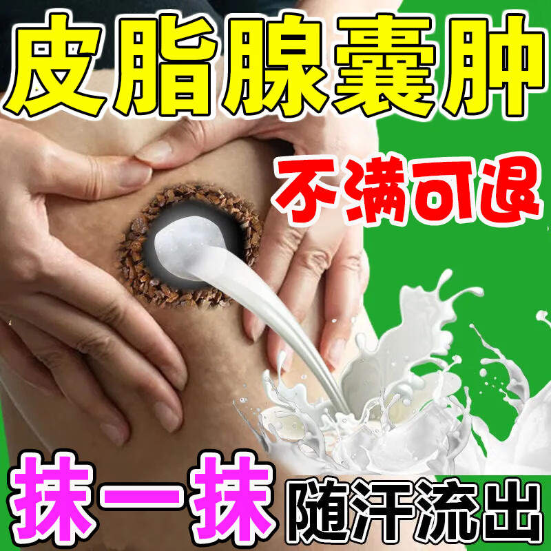皮脂腺囊肿膏粉瘤火疖拔i毒去除皮下痘痘脂肪硬块脓包结节专用草 单盒