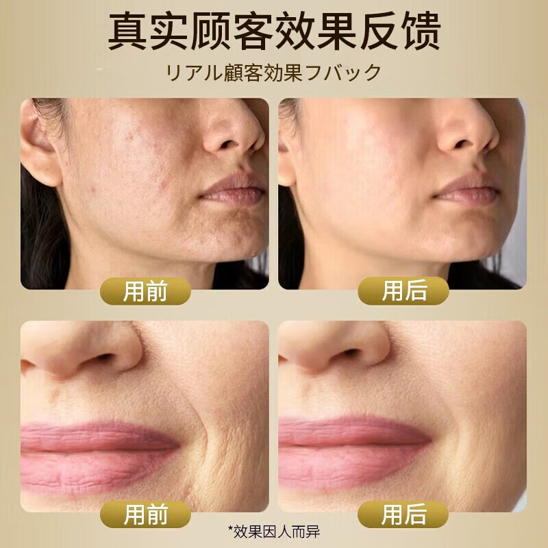 焦博士玻尿酸原液精华液抗皱紧致精华淡化细纹提拉紧致视黄醇次抛精华