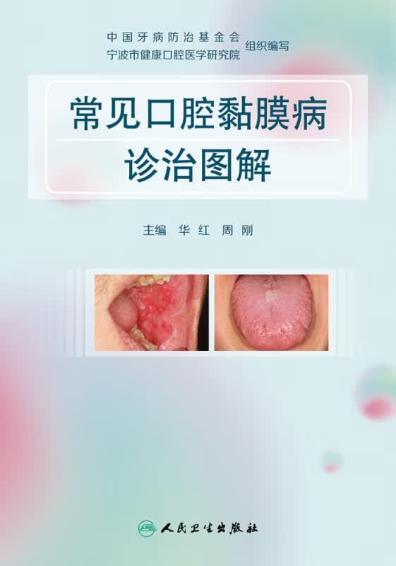 常见口腔黏膜病诊治图解 华红,周刚