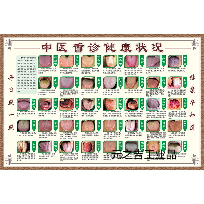 对照表图解医院挂图中医养生馆舌苔问题挂画 中医舌诊健康状况(合体)