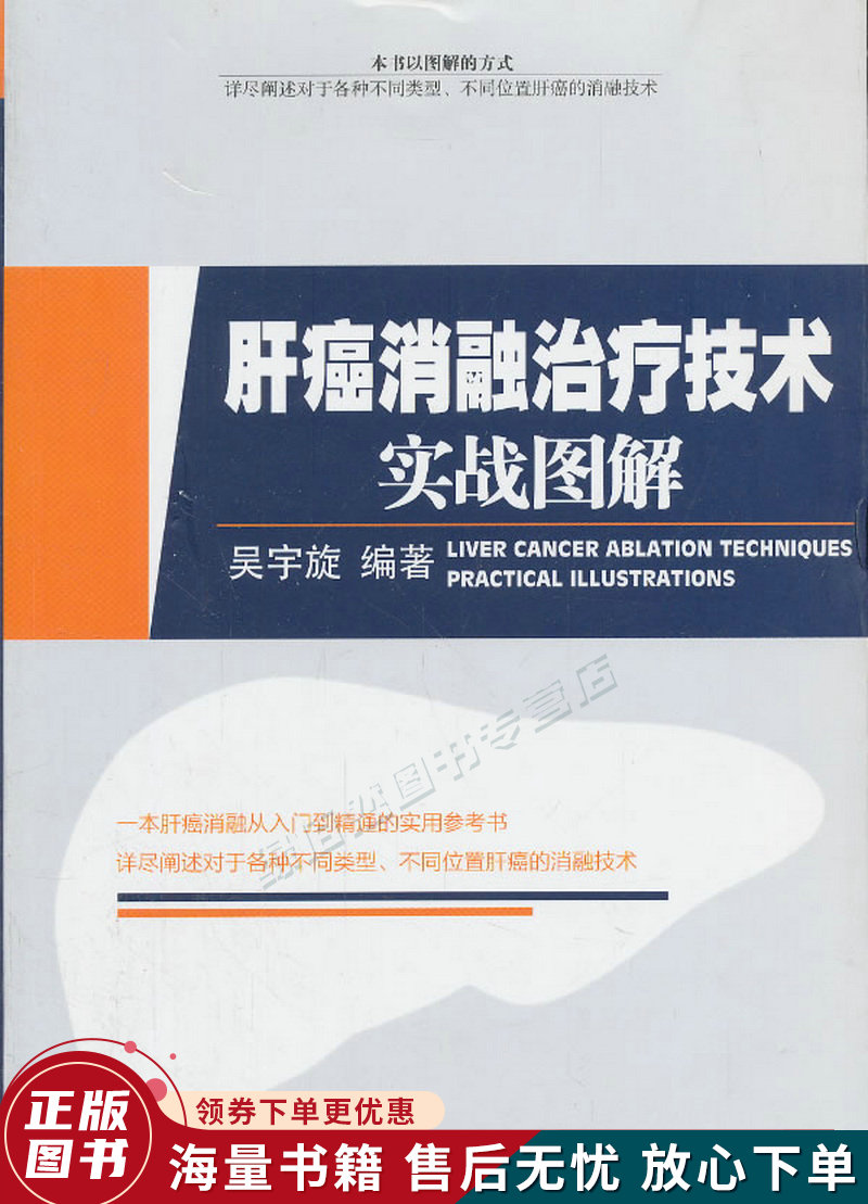肝癌消融治疗技术实战图解
