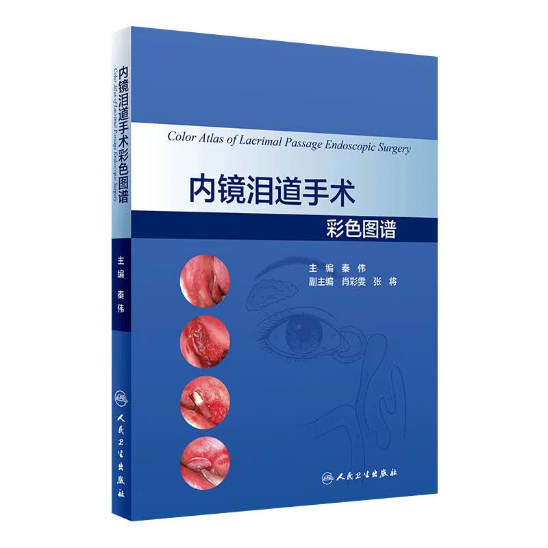 内镜泪道手术彩色图谱