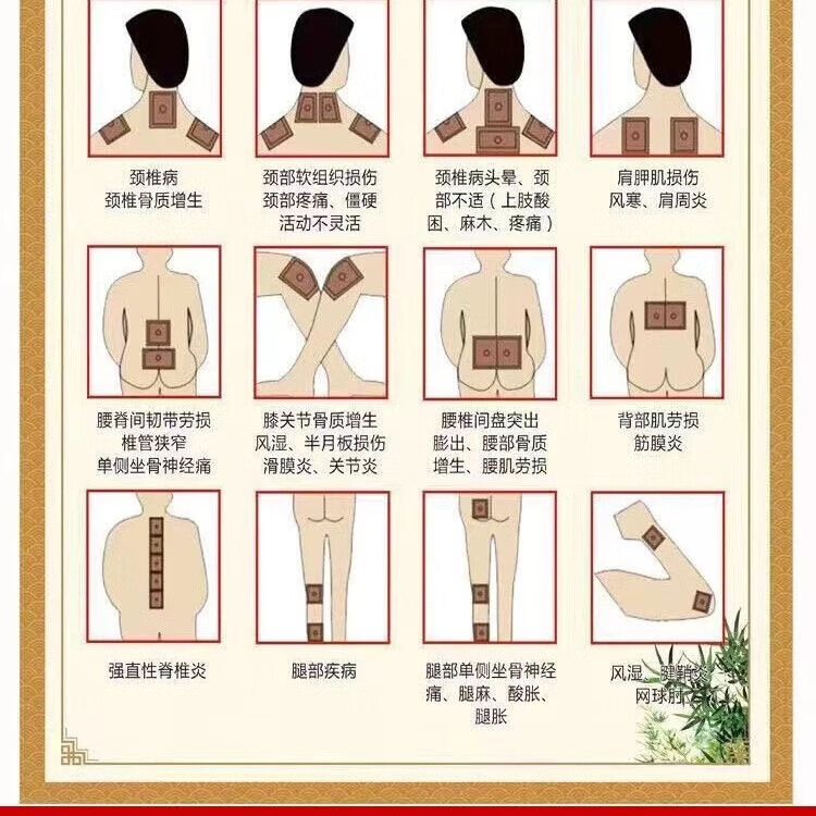 吕家传正品穴位贴一类器械膏药肩周炎腰肌劳损颈椎贴膏药家庭护理贴膏药 吕家传一盒10贴送一贴试用