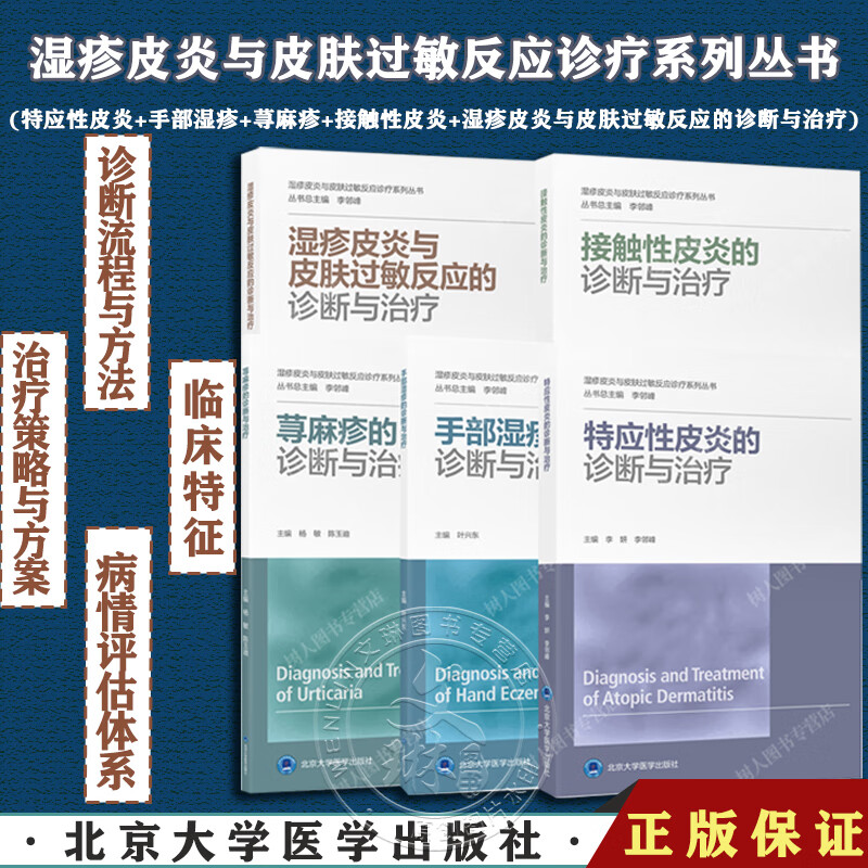全5册 特应性皮炎+手部湿疹+荨麻疹+接触性皮炎+湿疹皮炎与皮肤过敏反应的诊断与治疗 湿疹皮炎与皮肤过敏反应诊疗系列丛书怎么看?