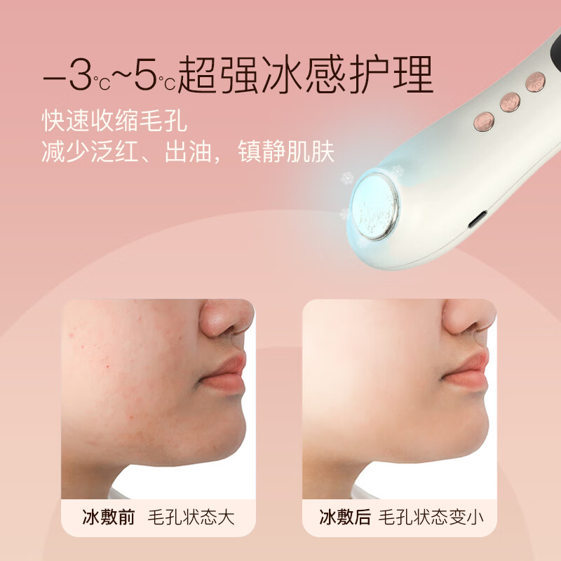 煦凛【德国】吸黑头仪清理神器强吸力吸出粉刺毛孔清洁器小气泡面部清洁美容仪送男女友礼物 白色【黑头+注氧】+吸头+导出液