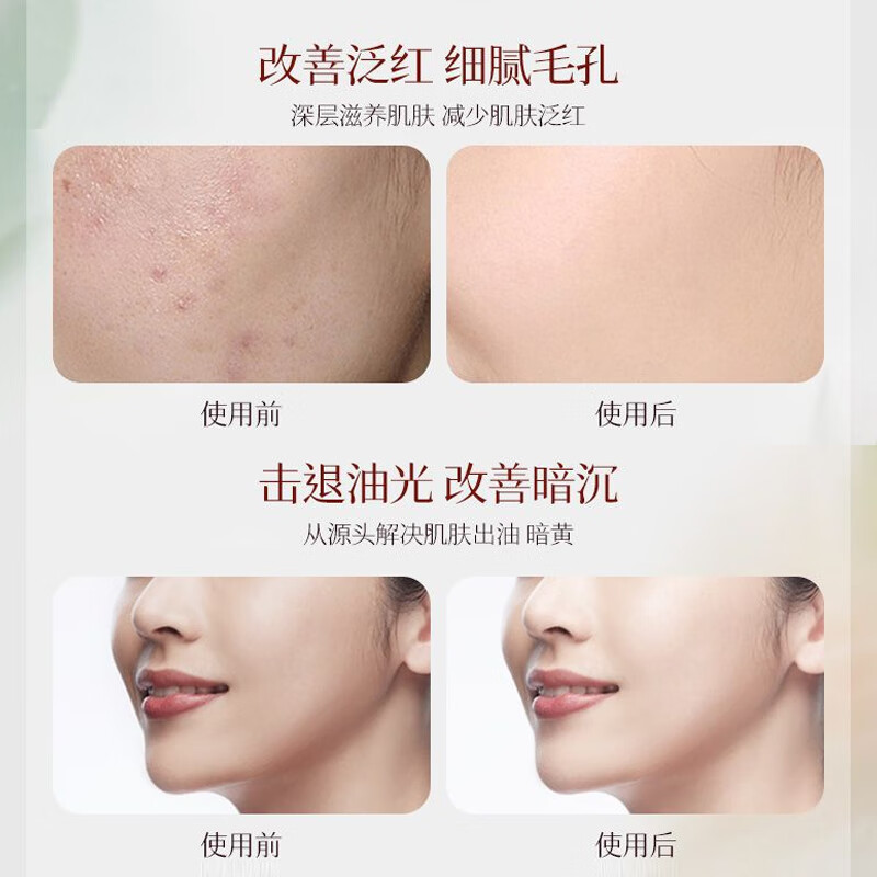 琪瑟黄芪精华水爽肤水护肤水补水保湿敷清爽控油柔肤水收缩毛孔化妆水 [套装]黄芪水+黄芪乳