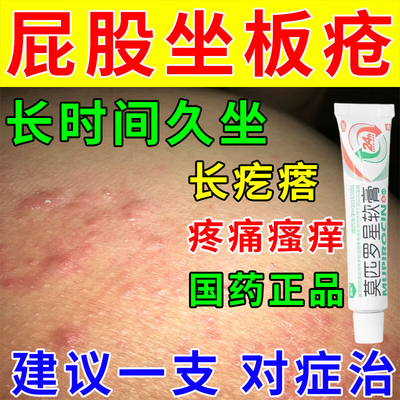 坐板疮久坐长疙瘩】屁股上长疙瘩脓疱湿疹痘痘屁股痒红痛大腿内侧湿痒