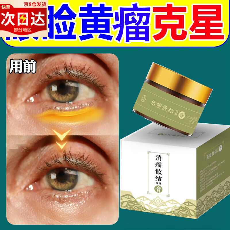 眼睑黄瘤疣膏克星眼睑板腺堵塞脂肪粒汗管瘤不去除眼部凸起黄疣留