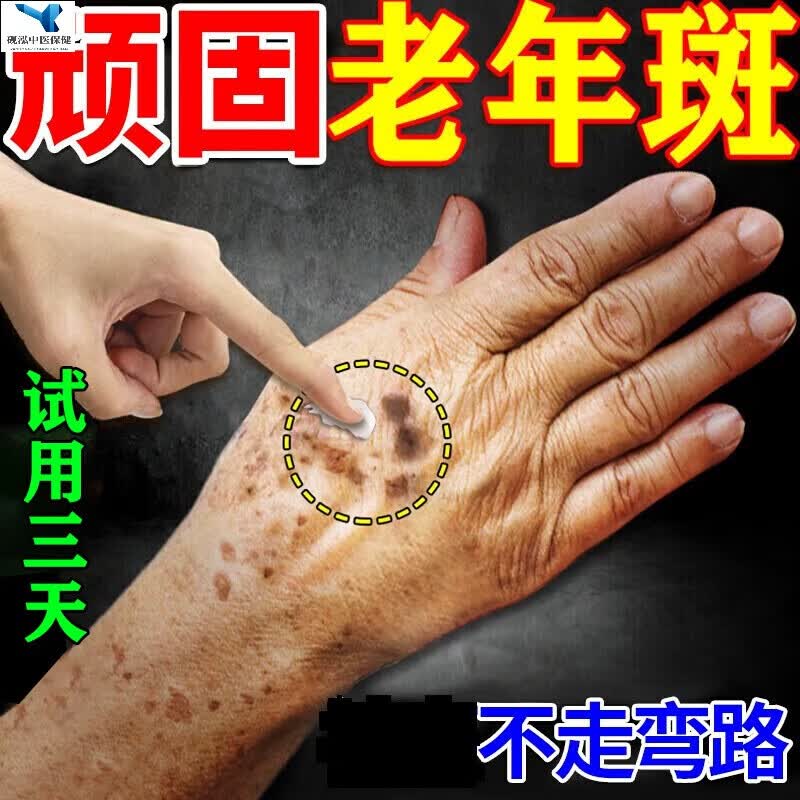 老年斑用非药品一夜脸消部手背美祛呿斑霜淡黑色素老年斑雀斑去呿除手
