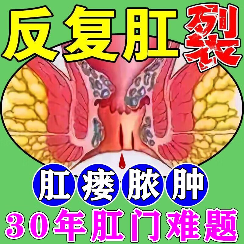 肛裂愈合膏大便出血肛瘘治疗药特有效肛周脓肿的药肛窦炎肛门瘙痒 1盒