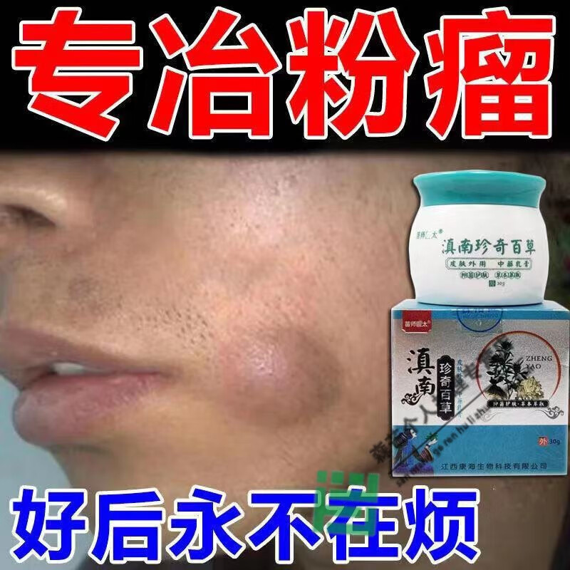 去除耳后粉瘤冶皮脂腺囊肿疏通皮下脂肪硬块疙瘩粉瘤消除膏治皮脂腺