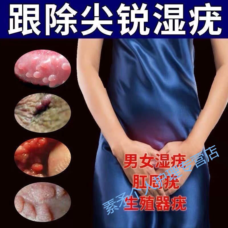 尖锐湿尤喷雾剂hpv男女私处l疣口腔疱诊疣阴i道龟i头肛周疣病毒感染