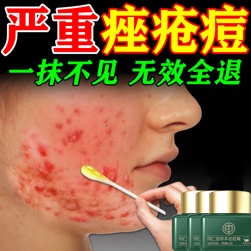 ���ڲ�����ͬ��������ӡ�޸�������ӡ�����޸�20g*3