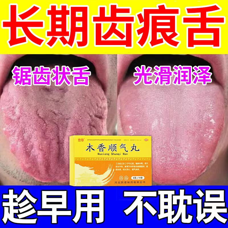 舌苔厚白齿痕舌健脾祛湿 治脾虚湿气重引起锯齿舌齿痕舌头开裂发白