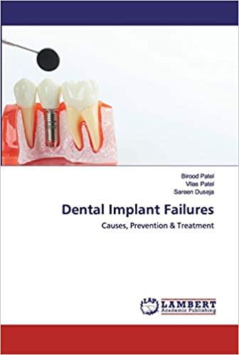 预订Dental Implant Failures