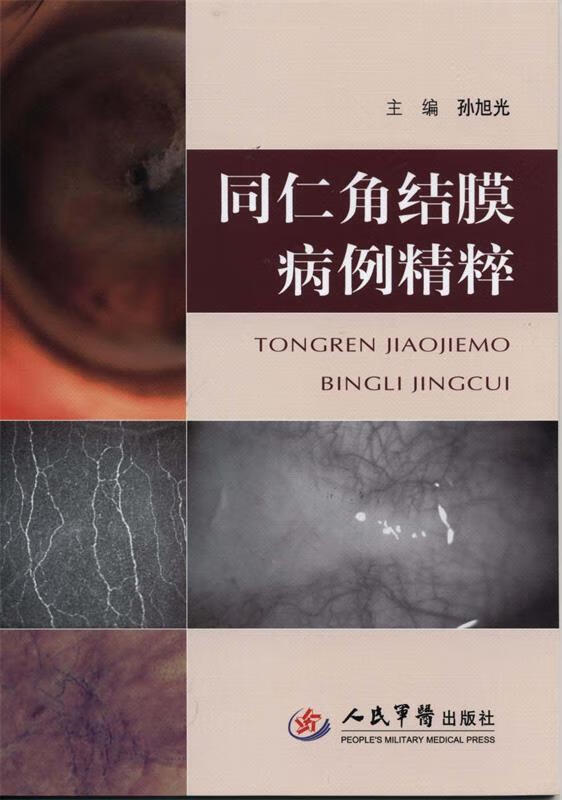 同仁角结膜病例精粹 孙旭光 人民军医出版社