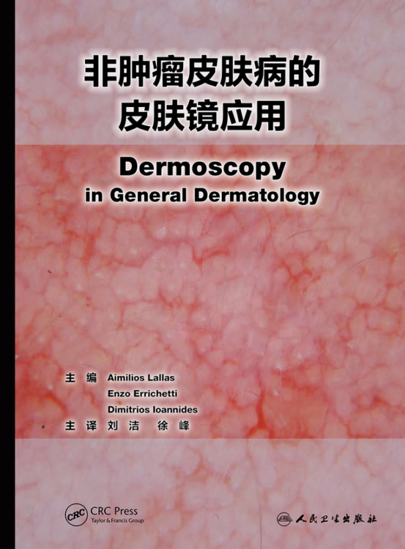 非肿瘤皮肤病的皮肤镜应用（翻译版）