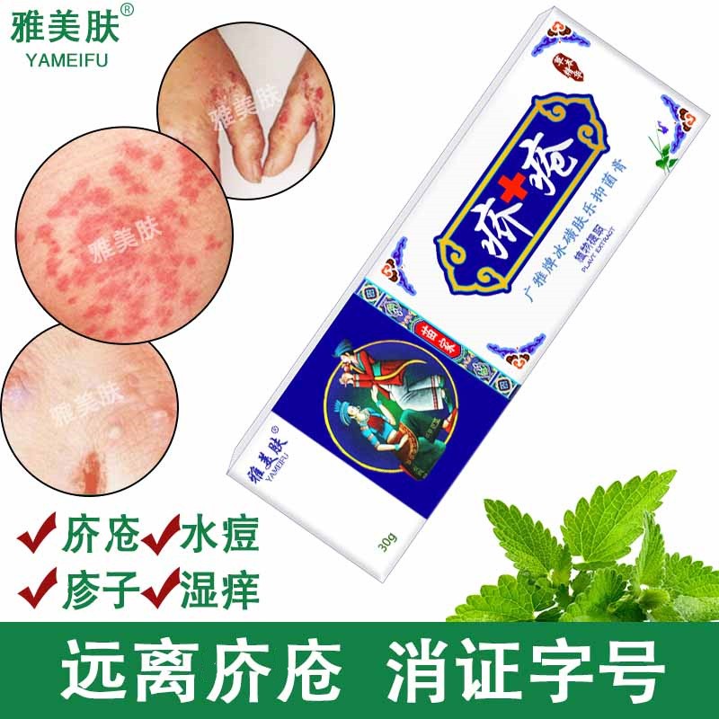 雅美肤疥疮专用膏硫磺软膏疥螨疥舒康疥灵霜疥得治