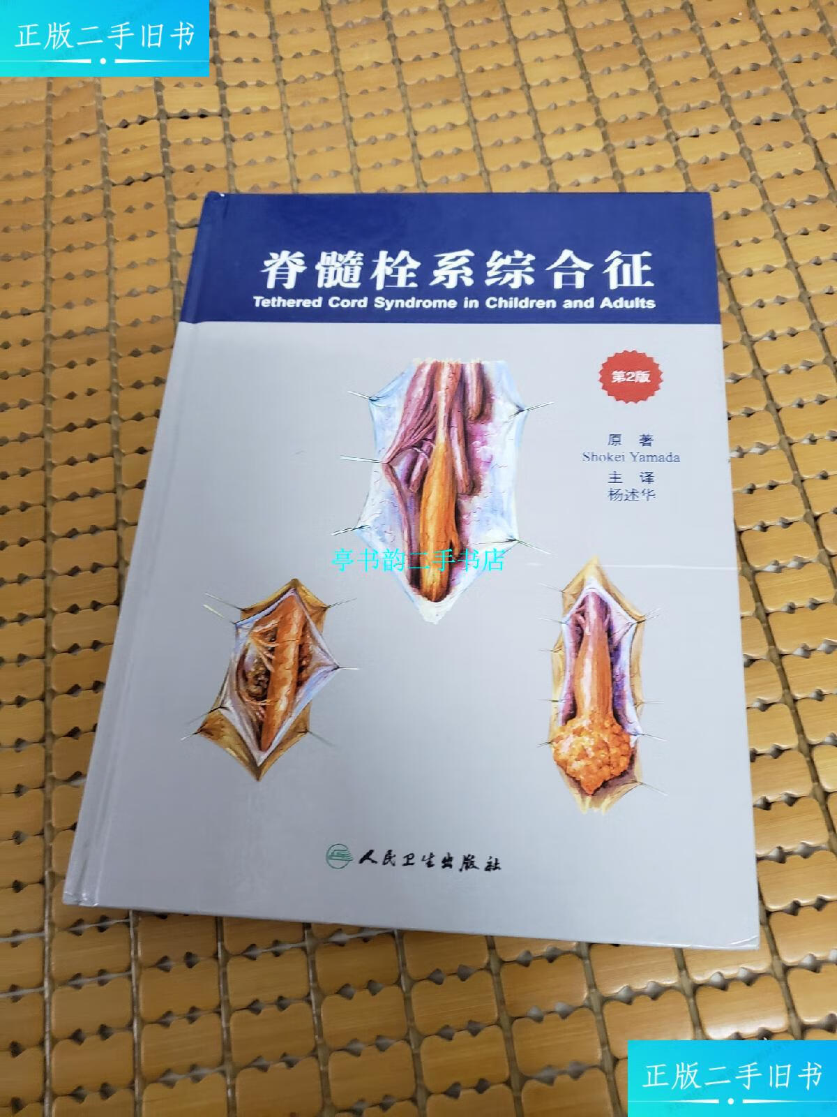 【二手9成新】脊髓栓系综合征(第2版) /[美] 人民卫生出版社