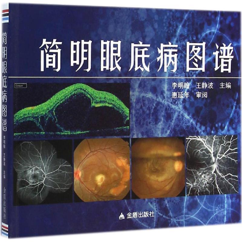 简明眼底病图谱 李明翰, 王静波【正版书】
