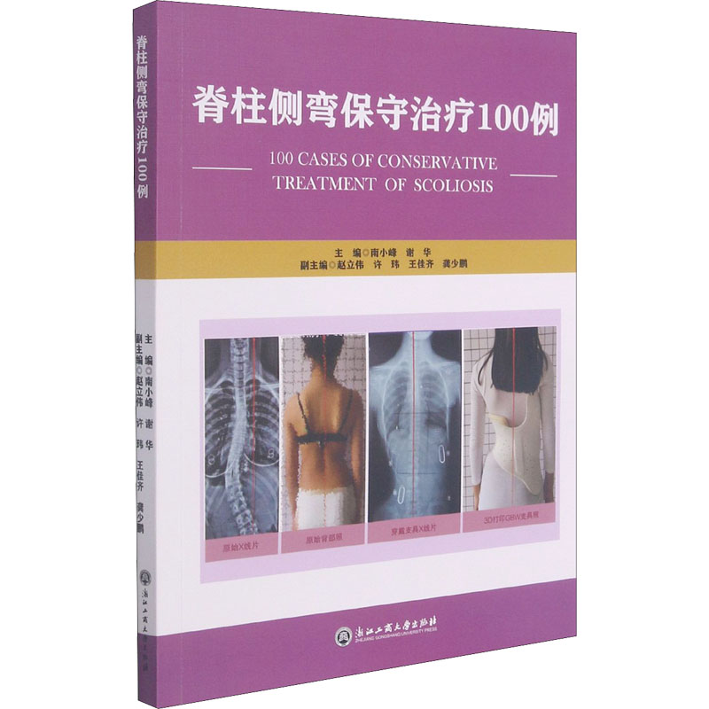 脊柱侧弯保守治疗100例 图书