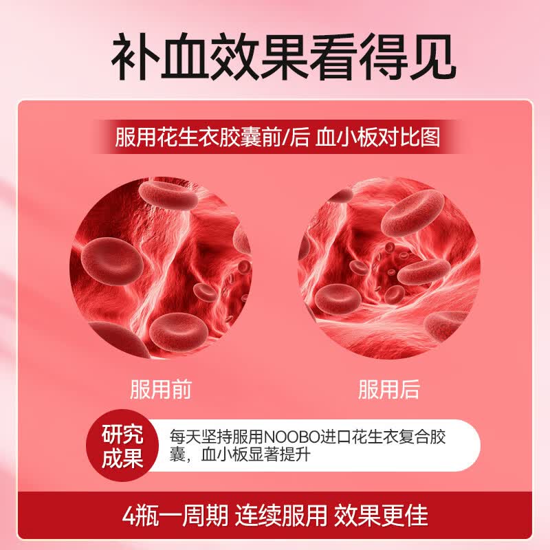NOOBO进口花生衣复合胶囊90粒血小板生成素女补气养血改善贫血女性调理 2瓶装【气血双盈 面色红润】 90粒*2瓶