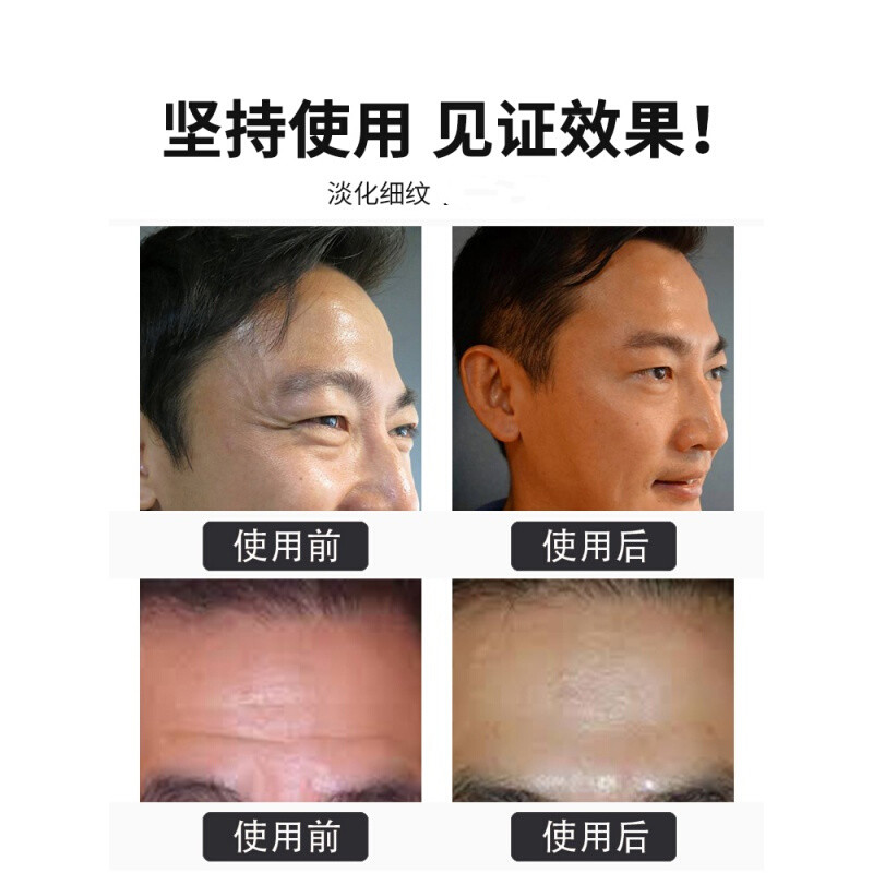 贝玲美六胜肽男士面膜补水纹法令纹抬头纹提拉紧致 六胜肽面膜30片+皱眼霜