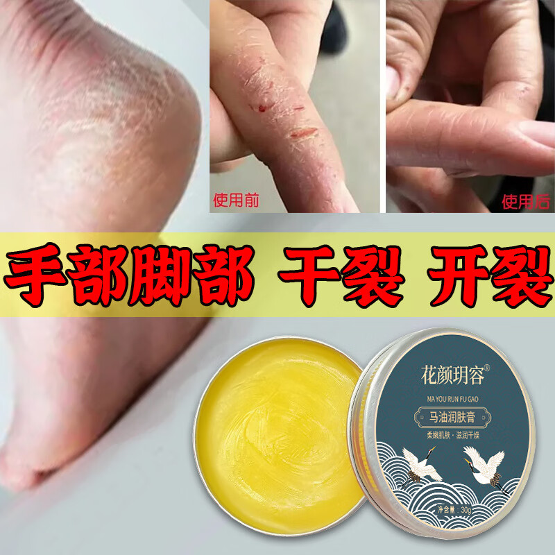 花颜玥容脚后跟开裂足裂手脚干裂马油膏防脚跟干燥皲裂保湿滋润护足